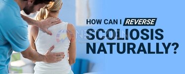 how-can-i-reverse-scoliosis-naturally.jpg